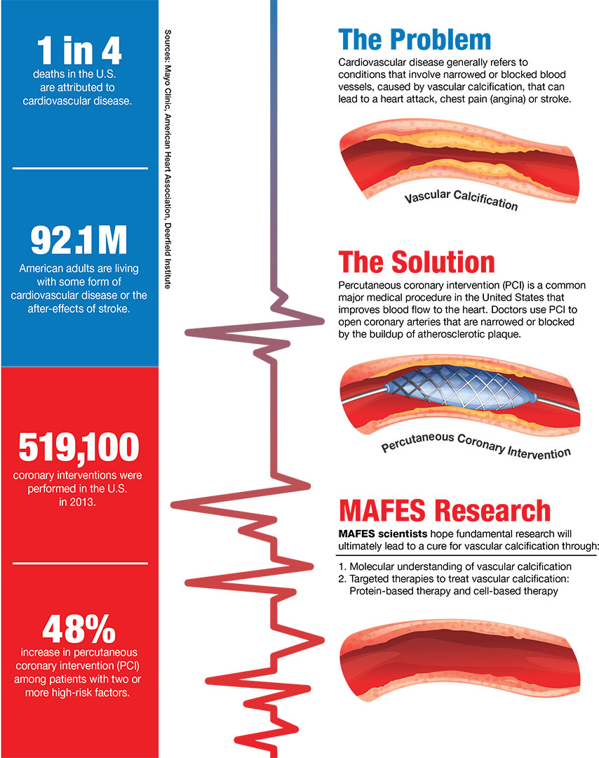 Biomedical engineers seek cure for vascular calcification